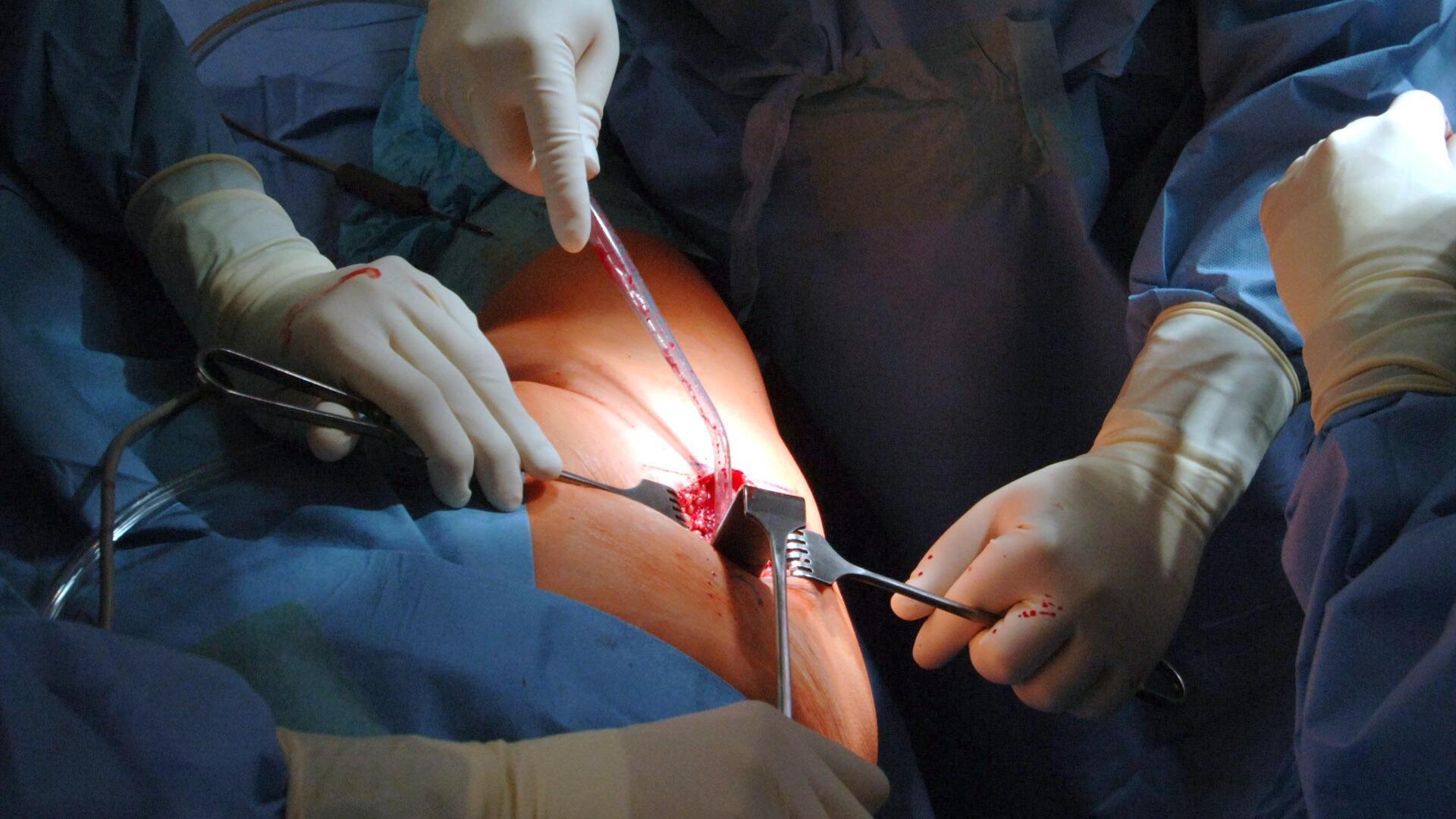 Die meisten Anträge von Patienten im Land Bremen, die einen Behandlungsfehler vermuten und sich an die Schlichtungsstelle wenden, kommen aus den Fachgebieten Orthopädie und Unfallchirurgie, sonstiger Chirurgie sowie der Inneren Medizin. 