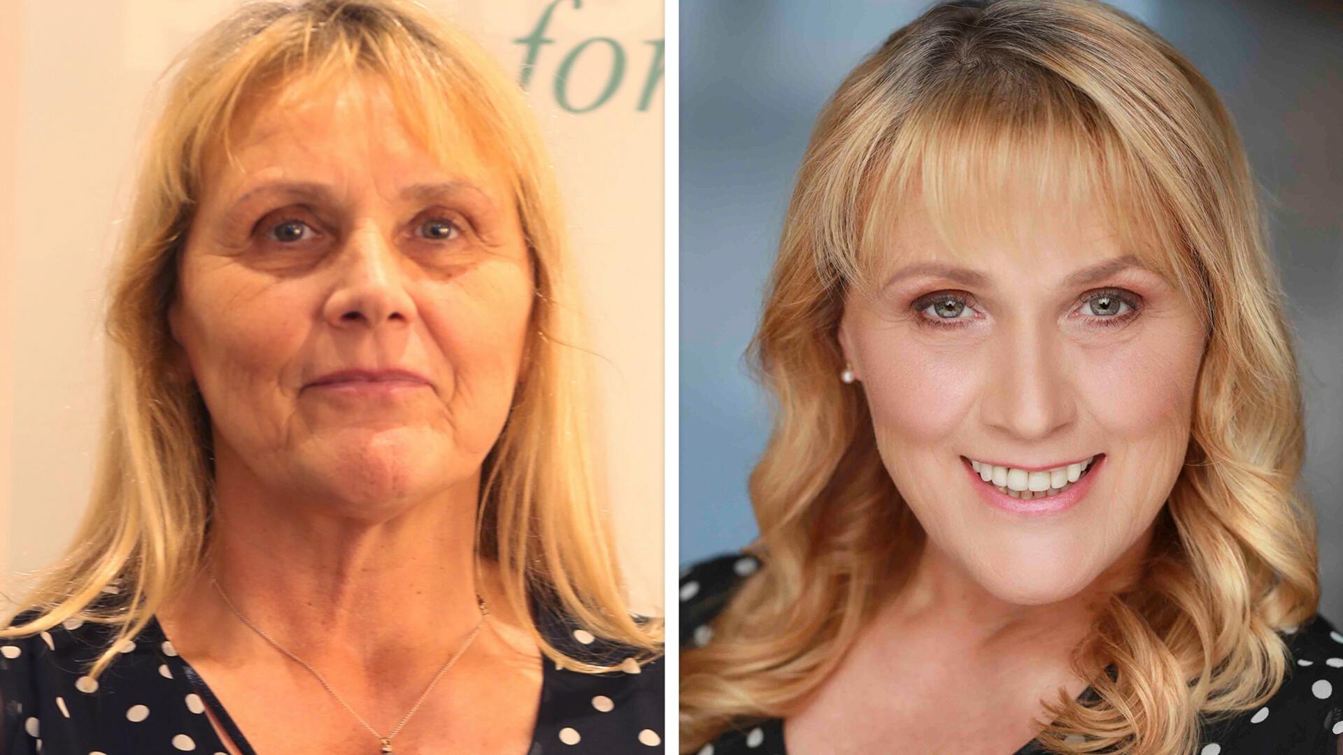 Eine Frau auf zwei Bildern